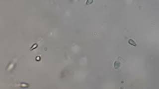 Human Sperm under the Microscope [upl. by Cortney]