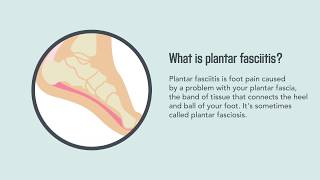 Plantar Fasciitis Causes Symptoms and Treatment  Merck Manual Consumer Version [upl. by Guzel]