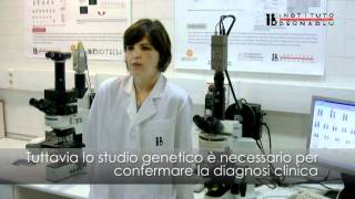 La Sindrome di Marfan e PGD diagnosi genetico embrionario [upl. by Kealey]