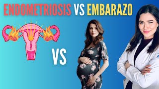 ¿Se puede conseguir un embarazo si tengo endometriosis [upl. by Annaeg]