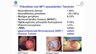 Dermatologie Neurofibromatose Katharina Wimmer [upl. by Lamont]