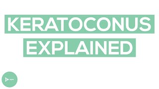 Keratoconus Explained  What Is Keratoconus and How Does It Impact Vision [upl. by Tisman308]