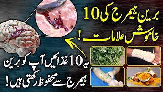 What Happens In Brain Hemorrhage  Symptoms Causes And Treatment Urdu Hindi [upl. by Suirada]