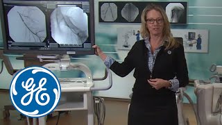 RSNA 2017 – The OEC Elite CFD Premium CArm with Flat Panel Detectors  GE Healthcare [upl. by Ingalls]