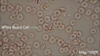 Red blood cells under the microscope hypo and hypertonic solutions [upl. by Autry]