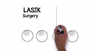 MN EYE What is LASIK [upl. by Strepphon]