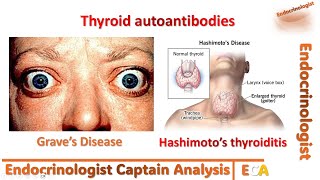 Understanding Autoimmune Thyroid Disease [upl. by Varian]