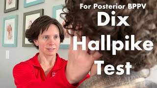 Dix Hallpike Test [upl. by Ledarf]