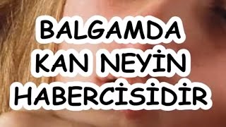 BALGAMDA KAN NEYİN HABERCİSİDİR [upl. by Burch]