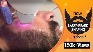 Permanent Laser Beard Shaping Treatment For Men  Beard Laser Hair Removal Men [upl. by Rodmun]