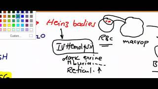 Usmle Step 1 Hematology 23 video [upl. by Naivad]