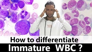 How to differentiate immature WBC [upl. by Gertrude]