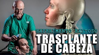 INMORTALIDAD PRIMER TRASPLANTE DE CABEZA DE UN SER HUMANO  SERGIO CANAVERO NEUROCIRUJANO [upl. by Francene780]