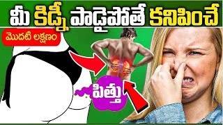 Kidney Disease Symptoms In Telugu  Kidney Disease  DrCL Venkat Rao  iD Health 360 [upl. by Airdnek]