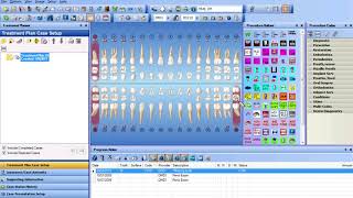 Dentrix Multiple Referal [upl. by Sucramed]