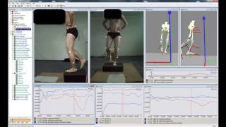 Biomechanical Screening of lower body in 3D with Simi [upl. by Madi364]