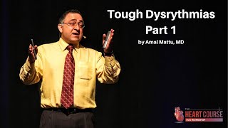 Tough Dysrythmias Part 1  The Heart Course HomeStudy ECG Workshop [upl. by Akema]