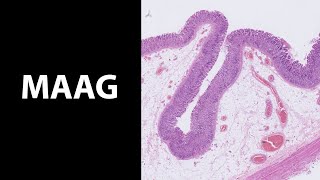 Maag wat een fraai epitheel De histologiemicroscopie van de maag [upl. by Amekahs]