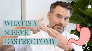 Bariatric Procedure Types  Gastric Sleeve Surgery [upl. by Neiman]