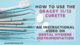 How to use the Gracey 1112 Curette [upl. by Shulman733]