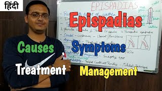 Epispadias Causes Symptoms Treatment Management RinkeshPariyani PathoPharma [upl. by Julie]