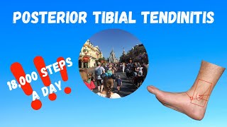 I Went to Walt Disney World and Now I Have Posterior Tibial Tendinitis A Review [upl. by Yclek]