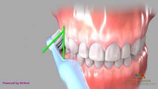 Brushing with Manual Toothbrush  Bass Technique [upl. by Wentworth501]