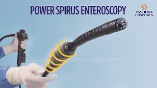 Power Spiral Enteroscopy A New Technology to Diagnose and Treat Small Intestine Diseases [upl. by Swart]