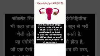 Whats a chocolate Cyst healthfacts amazingfacts health womenhealth gynae endometriosis [upl. by Marylee821]