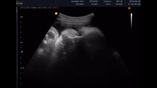 fetal ultrasound of 36 weeks37weeks baby boy moving [upl. by Clementas]