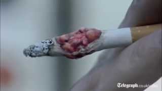 Graphic antismoking advert released in UK [upl. by Xaviera]