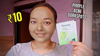 ₹10 Himalaya Purifying Neem Pack review  facepack for pimples acne amp darkspots  himalaya facepack [upl. by Ramirolg]