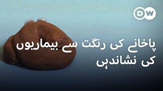 آپ کا پاخانہ کسی موذی مرض کی نشاندہی کر سکتا ہے؟  DW Urdu  Human Waste A Mirror to Our Health [upl. by Helbonnah899]