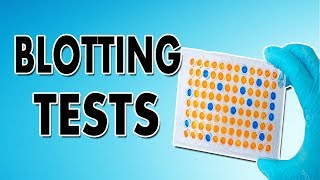 Blotting Techniques Western Blot Southern Blot and Northern Blot [upl. by Ynatirb]