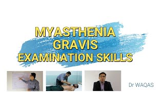 Myasthenia Gravis Examination of the patient [upl. by Aerdnak]