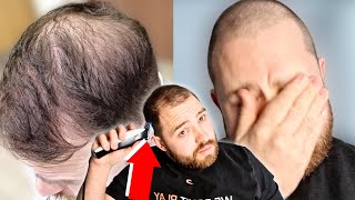 BALDING MAN DISTRAUGHT After Shaving Head BALD Emotional [upl. by Rumilly817]