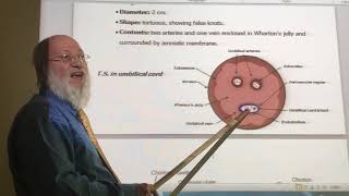 General embryology 30  Umbilical Cord  2nd part  by Dr Wahdan [upl. by Heisel]