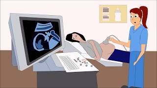 What is Preeclampsia Preeclampsia Animated Eclampsia [upl. by Weinhardt]