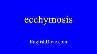 How to pronounce ecchymosis in American English [upl. by Adnuahsor587]