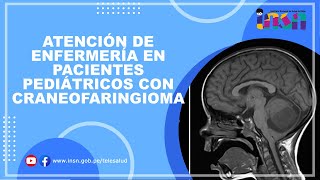 Atención de Enfermería en Pacientes Pediátricos con Craneofaringioma  Telecapacitación INSN [upl. by Fronniah]