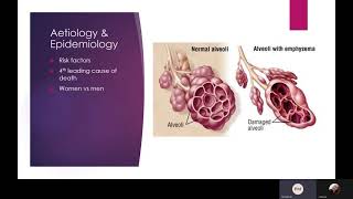 Emphysema COPD  A Case Study [upl. by Toscano]