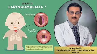 Laryngomalcia Stridor Symptoms Diagnosis amp Treatment I Dr Ankit Parakh Child Pulmonologist [upl. by Ahsiled]