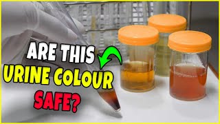 What your Urine Colour Says About Your Health [upl. by Nosyd]