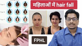 महिलाओं में hair fall  Female Pattern Hair loss Androgenetic Alopecia hairlosstreatment alopecia [upl. by Wolfort]