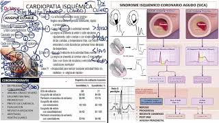 6 CARDIOPATIA ISQUEMICA DIAGNOSTICO [upl. by Kapeed]