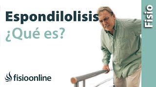 Espondilolisis  ¿Qué es [upl. by Nauqet]