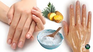 How To Remove Wrinkles From Hands Naturally in 2 Days [upl. by Harrak163]