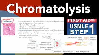 Chromatolysis Wallerian degeneration Axonal regeneration in HindiUrdu by first aid forUSMLE step1 [upl. by Gnouhk]