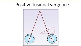 Orthopics series 5  Positive fusional vergence  PFV [upl. by Neenaej865]