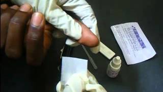 HIV Antibody Test Using A Rapid HIV Card [upl. by Malda]